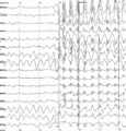 Thumbnail for version as of 18:46, 10 August 2025